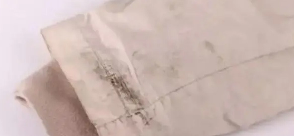 羽绒服陈年油渍太久怎样清洗