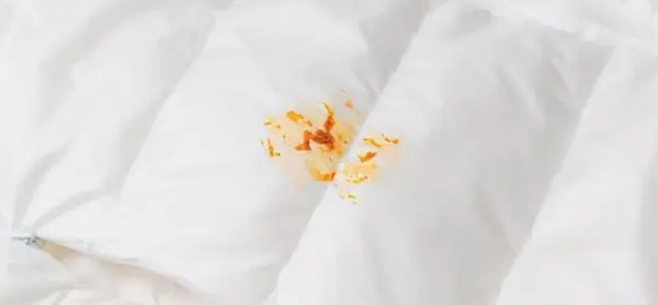 羽绒服陈年油渍太久怎样清洗