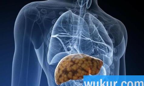 补硒治愈了我的肝病真的吗
