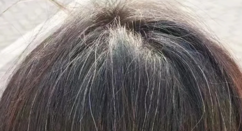 何首乌洗发水洗白发变黑是真的吗